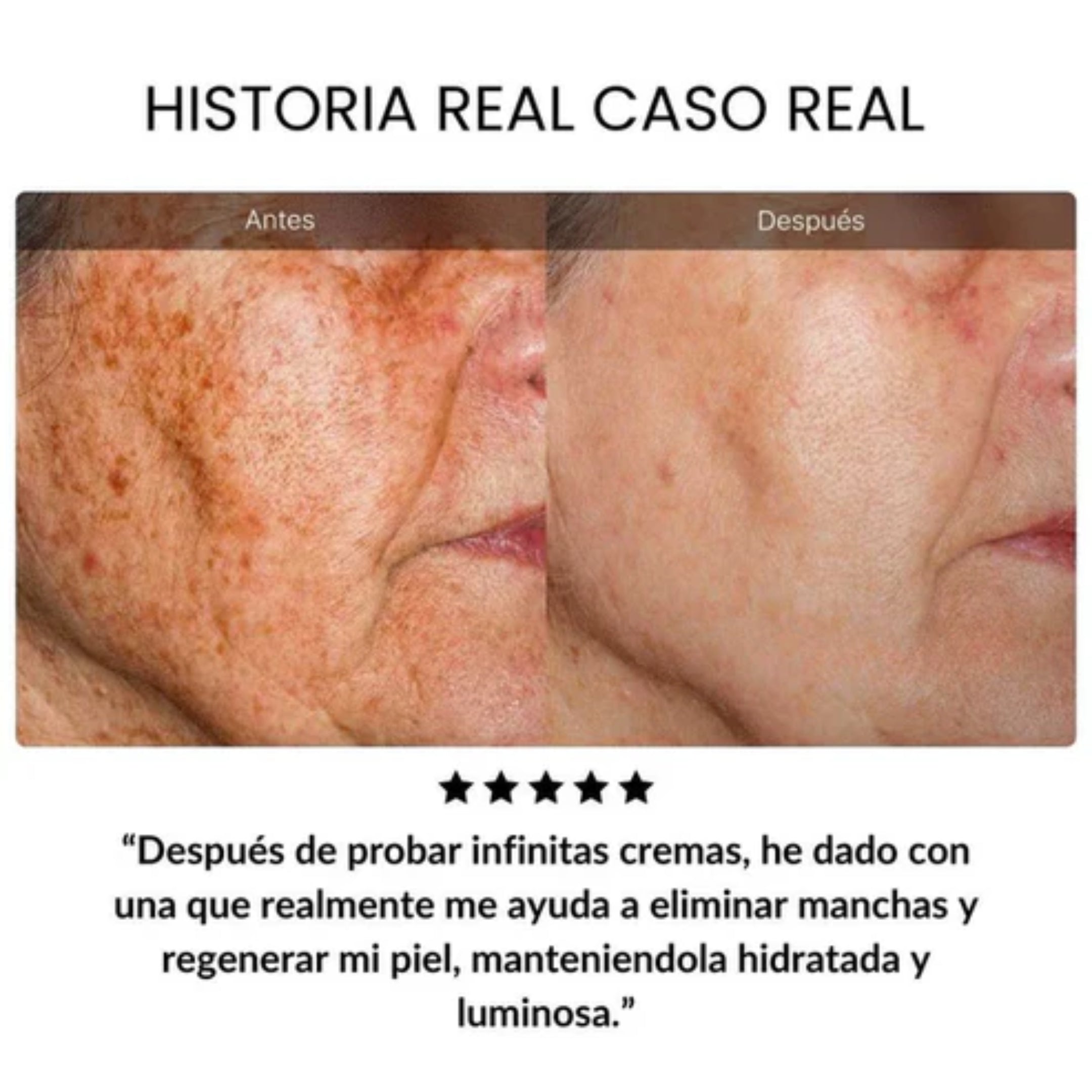 KIT Rejuvenecedor INFIBELLA OFERTA 3X1